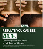 ALPHA ERGUEN™ TREATMENT 500ml