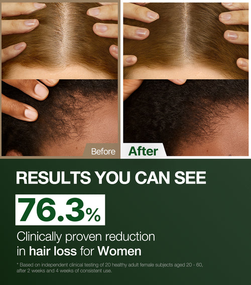 ALPHA ERGUEN™ HAIR TONIC 150ml